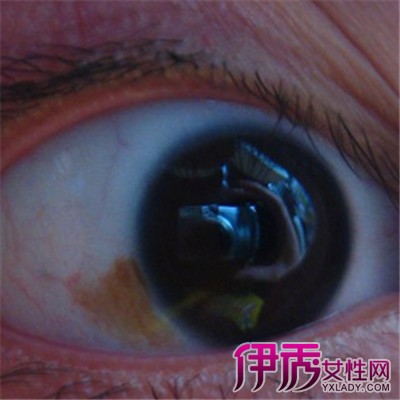 【图】眼睛黄斑病变是什么引起的 减少用眼时