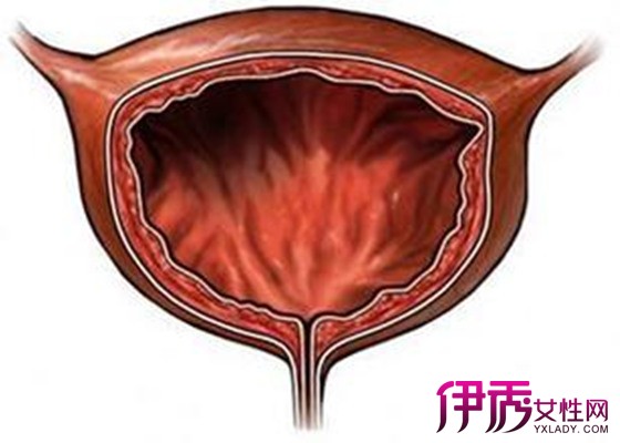 【圖】腺性膀胱炎能活多久 告訴你腺性膀胱炎在飲食上需要注意什麼