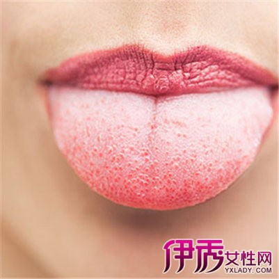 【图】舌苔和念珠菌舌头区别在哪里 专家给出专业意见及指导方法
