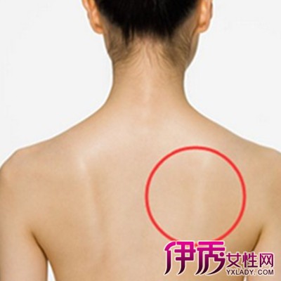 女性后背扇子骨疼痛图片