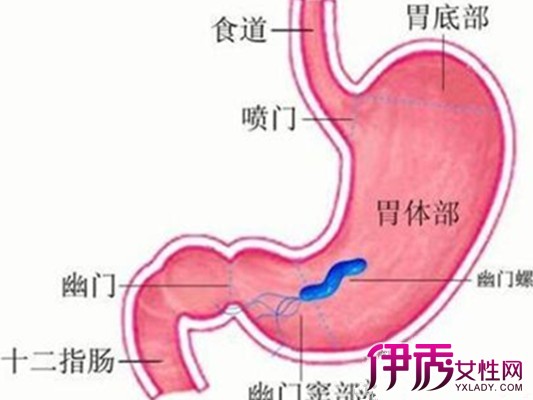 【胃肠炎最快的治疗方法】【图】急性胃肠炎最
