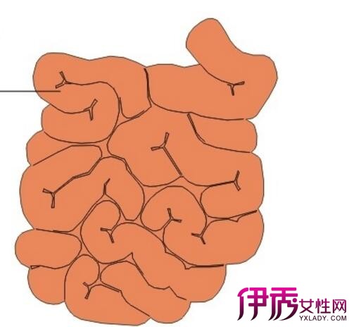 【阑尾手术后肠粘连症状】【图】阑尾手术后肠