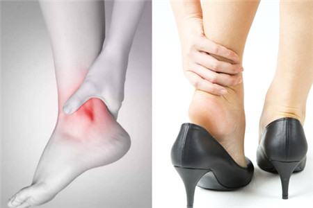【图】左脚踝肿是什么原因 是否是这八大病症