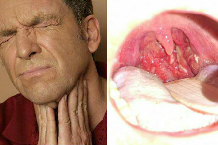 健康喉咙内部图片图片