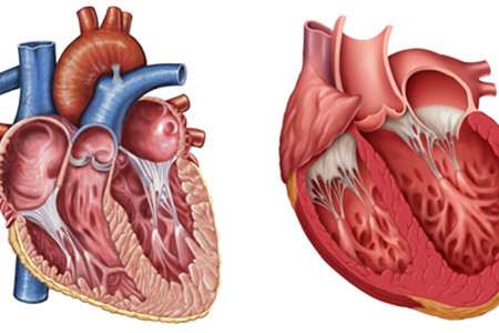 左心室肥大怎么办图片