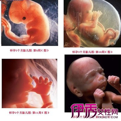 给你看怀孕三个月图! 3个月的胎儿是什么样的呢?
